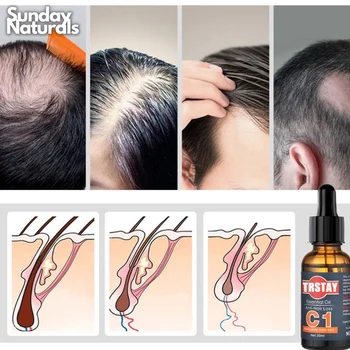 Масло для роста волос TRSTAY Authentic Hair Grower Product C1 Эфирные масла против выпадения волос Grow Up Serum